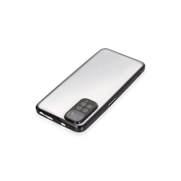 Xiaomi Redmi Note 11 Kılıf Razer Lensli Silikon - Siyah